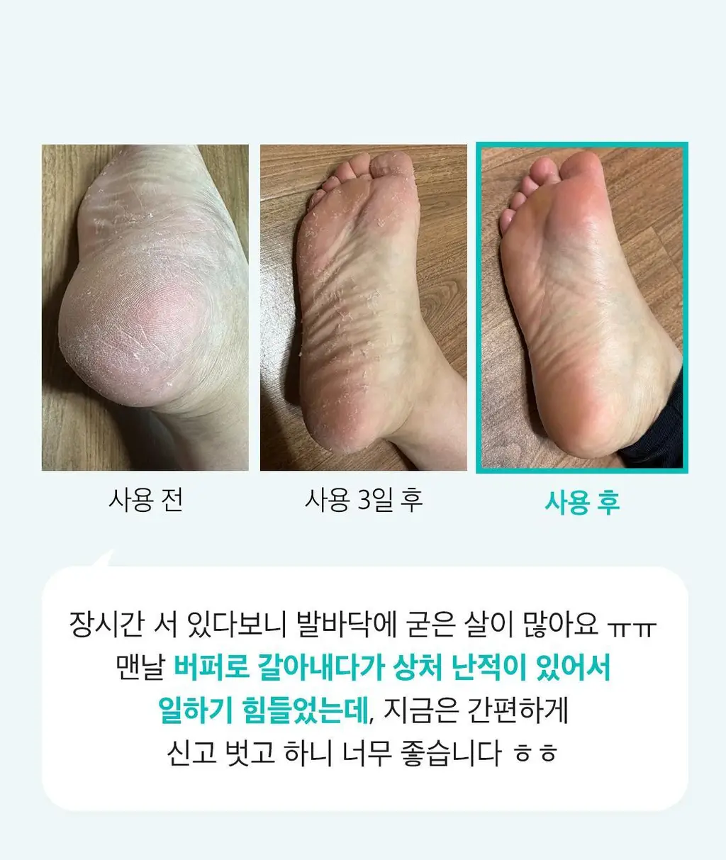 [발허물팩]아리얼 스무스앤퓨어 풋 필링 마스크 상세페이지 18